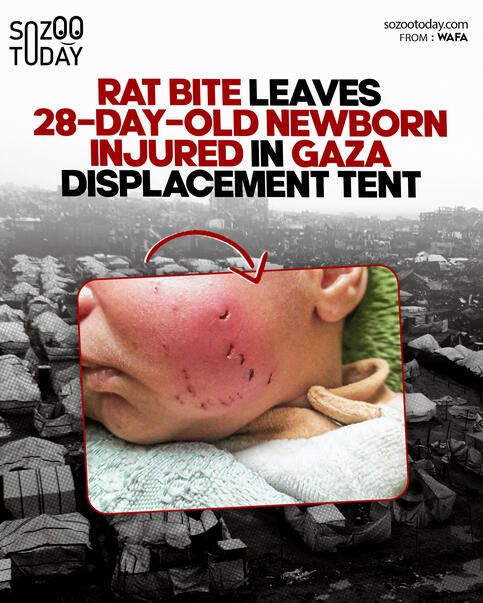 SOZOO TODAY OFFICIAL STATIC